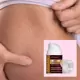 Speciális formula striák ellen - ANTI STRETCH (x3)